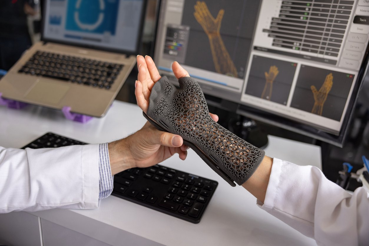 A 3D printed cast